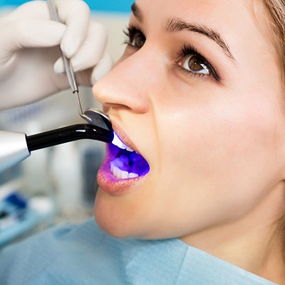 Dentist applying UV light to woman’s bonding treatment