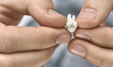 Close-up of a man holding an extracted tooth