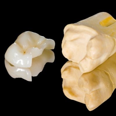 Model tooth with metal free dental restoration