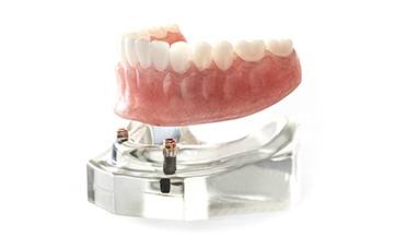 A set of dentures on a table