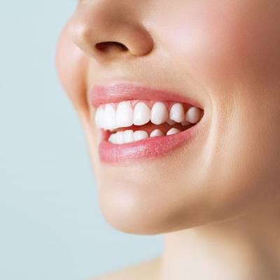 Close-up of woman’s beautiful smile with tooth-colored fillings in Chesapeake