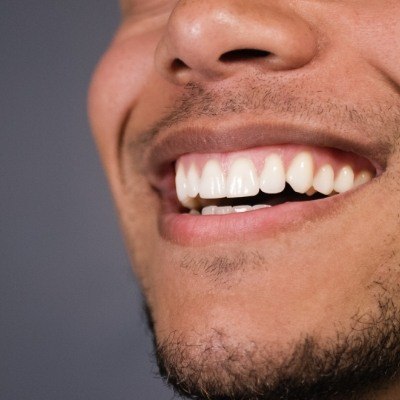 Closeup of healthy smile after gum recontouring