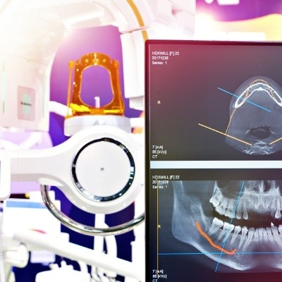 Advanced dental implant technology used to design and place dental implants