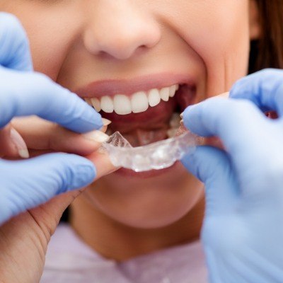 Dentist helping woman place an Invisalign aligner