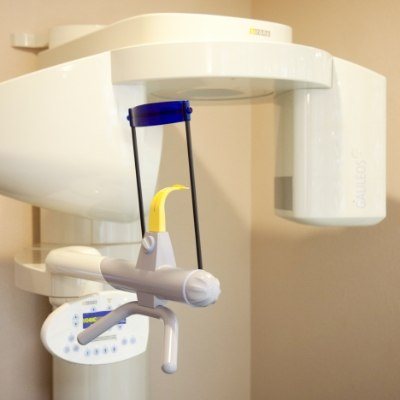 3 D C T cone beam digital x-ray scanner system