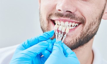 man preparing for the cost of veneers in Chesapeake