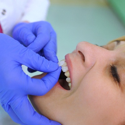 woman getting veneers in Chesapeake