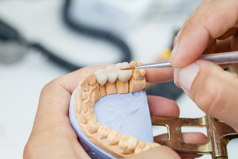 A dentist putting some finishing touches on the color of some dental crowns